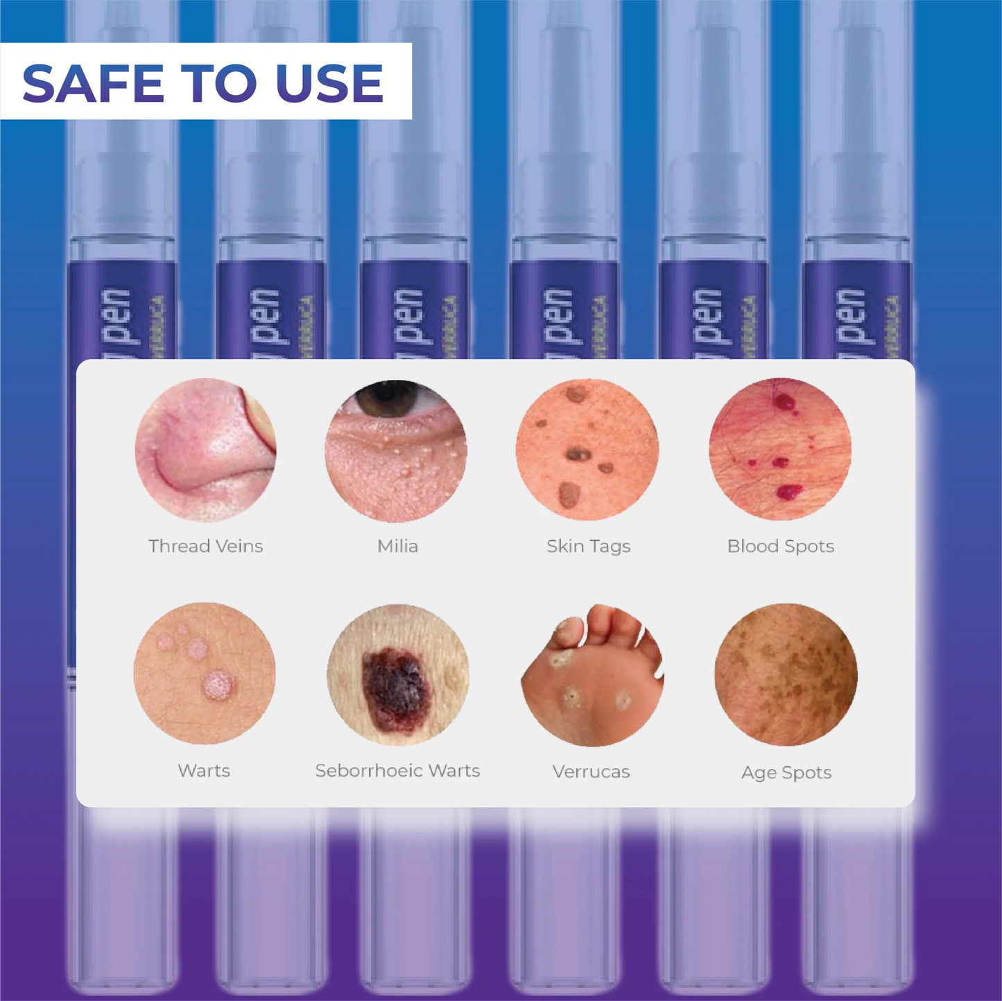 Wart Remover Skin Pen Gel - All Natural Way - Painless & Non Surgical
